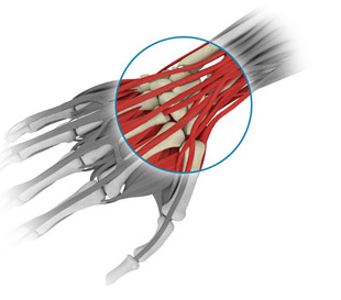 Clinique Chirurgicale de Laval | Wrist Hand | Arthroscopy of the wrist